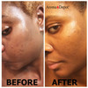 Aroma Depot Raw African Liquid Gallon Black Soap 100 Natural soap for Acne Eczema Psoriasis and Dry Skin Scar Removal Fa