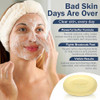 JOESOEF SKIN CARE Sulfur Soap for Acne Pharmaceutical Grade Dermatologists Approved for Acne Rosacea 100G