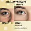 ceedoo Under Eye Patches - 24 Pairs Gold Under Eye Mask for Puffy Eyes, Dark Circles, Eye Bags, Wrinkles, Collagen Eye Gels with Rejuvenating Treatme online at globaldelivered
