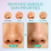 VOYOR Blackhead Remover Pore Vacuum Electric Face Vacuum Pore Cleaner Acne White Heads Removal with 6 Suction Heads BR41