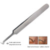 BEUKING Acne Blemish Blackhead Comedone Stainless Steel Nipper Blemish Extractor Tool for Remove Blackhead Acne Whitehea