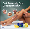 Original Udder Balm Tube Made in USA Extra Thick Udder Cream Hand Balm for Dry Skin Cracked Heels Rough Hands Deep Moist