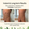 Adonia Organics LegTone Organic Cellulite Cream Natural AntiCellulite Treatment Firms Tightens Smooths Skin
