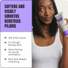 AmLactin KP Bumps Be Gone Therapeutic Body Cream for Keratosis Pilaris NoScrub Exfoliator and Body Moisturizer for Dry S