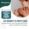 TreeActiv Crepey Skin Repair Cream 8 oz Firming Body Neck Cream with Hyaluronic Acid Glycolic Acid Shea Butter Helps Cre