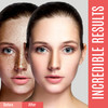 DERMAXGEN Dark Spot Corrector For Face and Body pigmentation Treatment Uneven Skin Tone Corrector For Face Body Underarm