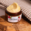Better Shea Butter Scar Eraser Balm Cocoa Butter Cream for Stretch Marks and Dark Spots Burns Old Scars Acne Scars Desig