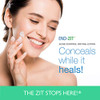 FastActing Acne Spot Treatment Drying Lotion MediumDark Shade Formula for Pimples Blemishes Conceals Dries Calms Skin No