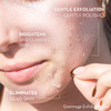 Sonage Gommage Exfoliating Gel Gentle Gommage Exfoliant for Face Facial Peeling Gel Removes Dead Skin Brightens Smooths