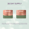Silc Skin Decollette Pad Medical Grade Chest Wrinkle Patches For Sleep Lines And Sun Damage Reusable Silicone Chest Pad