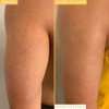 Farmacy Honeymoon Glow Body AHA and BHA Body Serum with Hyaluronic Acid Resurfacing Lactic Acid Body Lotion for Dry Skin