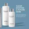 Jan Marini Skin Research Benzoyl Peroxide Acne Treatment Lotion 10 4 Oz