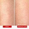 First Aid Beauty KP Bump Eraser Body Scrub with 10 AHA Keratosis Pilaris Skin Exfoliater with Glycolic and Lactic acids