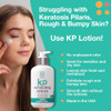 TOUCH Glycolic Acid Lotion for Keratosis Pilaris KP Exfoliating Body Lotion Moisturizer for AHA BHA Rough Bumpy Skin Get