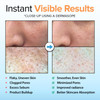 Ebanel Brightening Peeling Gel with Cotton Cellulose Rice Papaya Centella Hyaluronic Acid for Face and Body Gentle Exfol