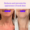 BLUMBODY Neck Wrinkle Patches AntiWrinkle Silicone Patches for Skin Firming Tightening Reusable Overnight Pads AntiAging