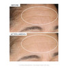 StriVectin Advanced Retinol Intensive Night Moisturizer Targets Visible Signs of Aging for Healthier Skin 17 Fl Oz