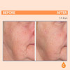 Serious Skincare SeriousC3 Plasma Vitamin C Restore Restoration Night Cream for Deep Hydration Hydrolyzed Collagen Hydra
