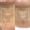Wrinkles Schminkles Neck Wrinkle Patch Reusable Silicone Smoothing Pads Sensitively Formulated Wrinkle Patches Reduce Wr