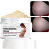 Rosarden Stretch Mark Prevention Cream for Pregnancy Stretch Mark Cream Remover Stretch Mark Lotion for Pregnancy Tummy
