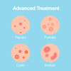 Saplaya KBeauty Ance Care Hydrocolloid Patches For Acne Pimple Care 100 Hydrocolloid Acne Spot Healing Patch