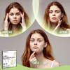 AUSLKA Blemishes Patches 44 Strips Hydrocolloid Dots Large Blemishes Patch Blemishes Stickers Zit Breakouts Suitable for