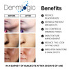 Acne Treatment Pads Contains Salicylic Glycolic Lactic Acid for Face Body Clears Away Clogged Pores Oily Skin Cystic Bre