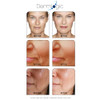Anti Aging Resurfacing Peel Pads Triple Action Chemical Peel Pads Combined with Glycolic Lactic and Salicylic Acids Smoo