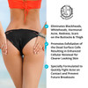 AntiAcne Buttocks Thigh Treatment Clears Away Acne Pimples Zits Dark Spots Ingrown Hairs on the Buttocks Thigh Area Prev