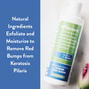 KP Elements Body Scrub 8 fl oz Keratosis Pilaris Treatment Exfoliating Body Scrub and Body Moisturizer for Dry Skin Help