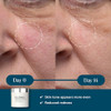 ELEMIS Dynamic Resurfacing Facial Pads Blackhead Refining Treatment Gentle Daily Skin Resurfacer Lactic Acid TriEnzyme 6