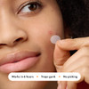 Mighty Patch Variety Pack from Hero Cosmetics Hydrocolloid Acne Pimple Patches for Covering Zits and Blemishes Spot Stic