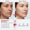 Alpha Skin Care Enhanced Renewal Cream AntiAging Formula 12 Glycolic AHA Reduces Lines Wrinkles Normal to Dry Skin 2 Oz
