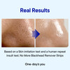 ONEDAYS YOU PZ SSOC SSOC Blackhead Remover Strips Korean Pore Strips for Face Nose Deep Cleansing Pore Strips Blackhead