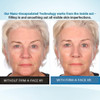 Serious Skincare Firm A Face XR Instant Temporary Skin Tightener Invisible Lift for Face and Neck with Retinol AntiAging