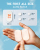 LitBear Large Acne Pimple Patches 5 Sizes 80 Patches for Large Breakouts Acne Patches for Face Chin or Body Acne Spot Pa