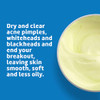 De La Cruz 10 Sulfur Ointment Travel Size Cystic Acne Treatment for Face and Body Daily 10 Min Spot Treatment Mask Safe
