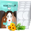 LitBear Acne Patches Large Hydrocolloid Pimple Patches for Breakouts Zit and Blemish Large Acne Patches for Face Chin Ba