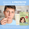 Acne Patches for Face Hydrocolloid Bandages 24 Count Pimple Patches for Face in 3 Universal Sizes Acne Spot Treatment Ca