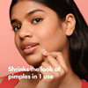 Mighty Patch Original Patch from Hero Cosmetics 1 Hydrocolloid Acne Pimple Patches for Face Shrinking Zits Whiteheads in