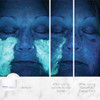 NassifMD Exfoliating Detox Pads SurgeonCreated AHABHA Facial Pads for Deep Cleansing Smoother Texture Glowing Skin Reduc
