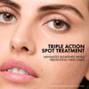 Vichy Normaderm SOS Acne Rescue Spot Corrector Acne Spot Treatment for Face with 10 Sulfur Niacinamide Glycolic Acid Sui