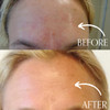 Radical Skincare AgeDefying Exfoliating Pads Remove Dead Skin Even Brighten Skin Tone for Radiant Glow For All Skin Type