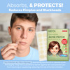 Acne Absorbing Covers Hydrocolloid Acne Care Bandages 240 Count Three Universal Patch Sizes Acne Blemish Treatment for F