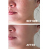 The Ceel Facial Peeling Serum With 10 AHA 2 BHA Saliscylic Acid Serum for Blemishes Chemical Peel at Home Glycolic Acid
