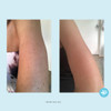 HydroGlo Peel Pads Enhanced with Kojic Mandelic Glutathione Licorice Papaya Pineapple Bearberry Extracts 10 Strength Pee