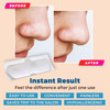 MEDca Deep Cleansing Blackhead Pore Strips Pack of 24 Peel Off Blackhead Remover and Pore Unclogging Strips for Nose and