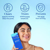 Differin Acne Treatment Gel 30 Day Supply Retinoid Treatment for Face with 01 Adapalene Gentle Skin Care for Acne Prone