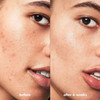 elf SKIN Blemish Breakthrough Blemish Control Basics Kit TravelSize Acne Skincare Routine Cleanser Serum Moisturizer Veg