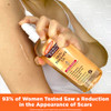 Palmers Cocoa Butter Formula Skin Therapy Moisturizing Body Oil with Vitamin E Rosehip Fragrance 51 Ounces